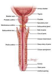 Penile Implant treatment in delhi ncr india