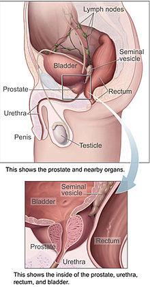 Uro Oncology treatment in delhi ncr india